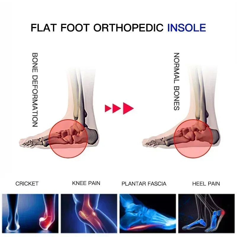 Semelles Orthopédiques Sport & Récupération Pro™